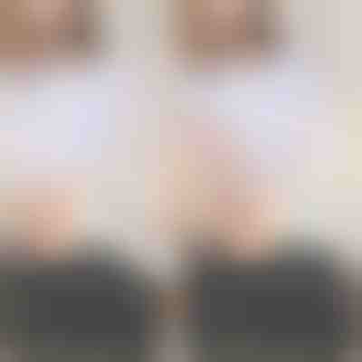 Invisible silicone shoulder enhancers (2 pairs/set) | CLARIPAD